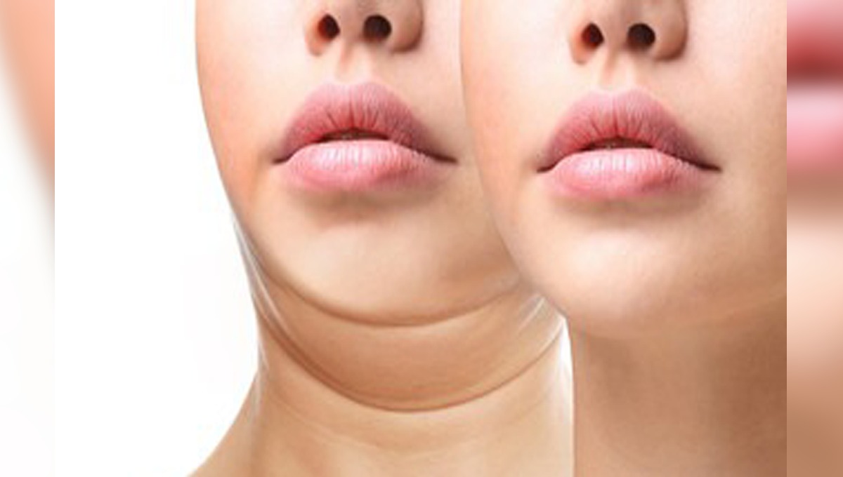 ڈبل چن سے نجات پانے کے 3 آسان ٹوٹکے جو کریں آپ کے چہرے کو دبلا