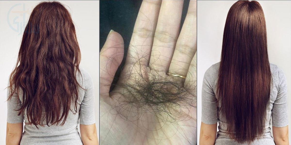 اگر ری بونڈنگ کے بعد آپ کے بال بھی گر رہے ہیں تو کیا کریں؟ جانیئے ان کو گرنے سے روکنے کے کچھ آسان طریقے