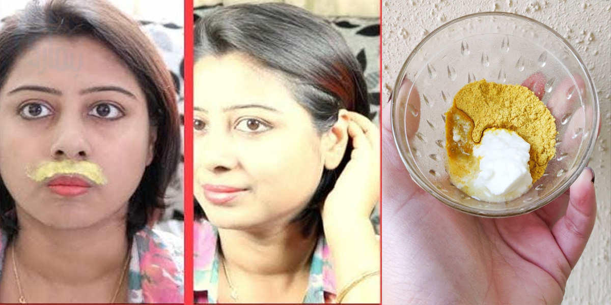 چہرے پر ٹوتھ پیسٹ لگائیں، اضافی بالوں سے جان چھڑائیں ۔۔ جانیئے ڈاکٹرز خواتین کے چہرے کے غیر ضرور بالوں کو ختم کرنے کے لئے کون سے آسان سستے اور گھریلو طریقے بتاتے ہیں؟