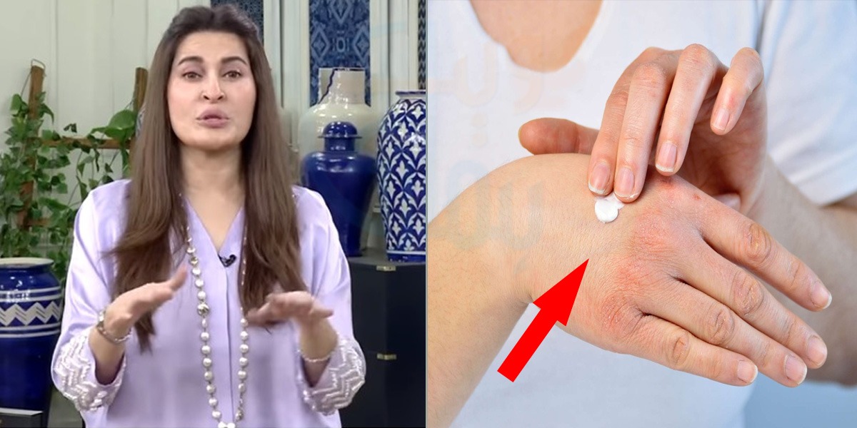 ڈرائی سکن کی وجہ سے بار بار لوشن لگاتے ہیں تو جانیئے ڈاکٹر شائستہ اس سے بچنے کا کیا طریقہ بتاتی ہیں؟