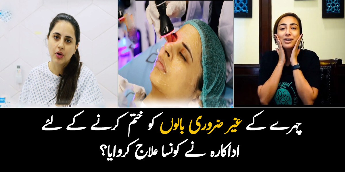 چہرے کے غیر ضروری بالوں کو ختم کرنے کے لئے اداکارہ نے کونسا علاج کروایا؟ جانیئے آج کل یہ مشہور اداکار کون سے مختلف ٹریٹمنٹس کروا رہے ہیں؟