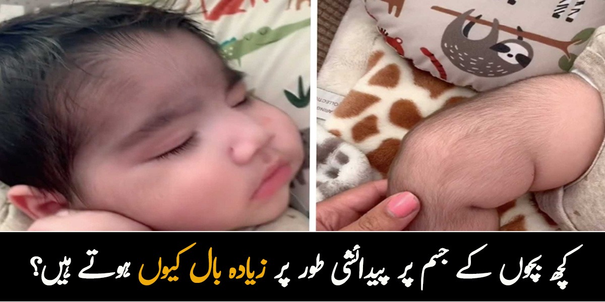 جب میں نے بچے کو دیکھا تو ڈر گئی، اس کے جسم پر ڈھیروں بال تھے ۔۔ کچھ بچوں کے جسم پر پیدائشی طور پر زیادہ بال کیوں ہوتے ہیں؟