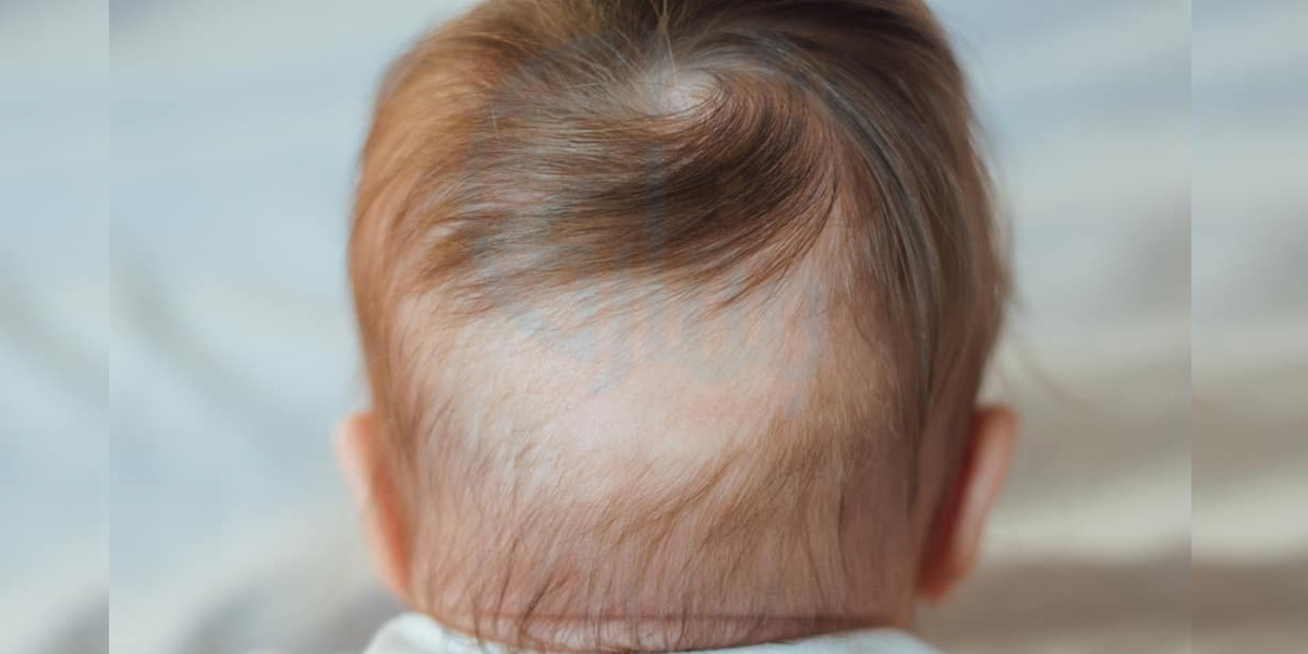 اگر آپ کے بچے کے سر پر بال پیدائشی طور پر کم ہیں ۔۔ تو یہ ٹپ آزما کر دیکھیں آپ بھی حیران رہ جائیں گی