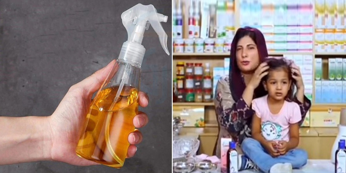 آپ کی بچی کے بال بہت ہلکے ہیں،بال بنانے میں سر کی جلد نظر آتی ہے؟ تو پھر ڈاکٹر بلقیس کا یہ نسخہ آپ کے لئے ہی ہے