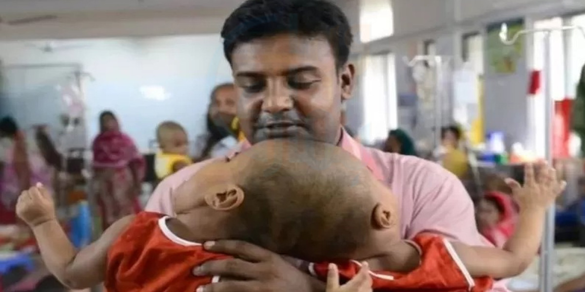 دو سر اور تین ہاتھوں والے بچے کیوں پیدا ہوتے ہیں اور پیدائش سے قبل بچوں کے جسمانی نقص کا کیسے پتہ لگایا جاتا ہے؟ ڈاکٹر کی رائے