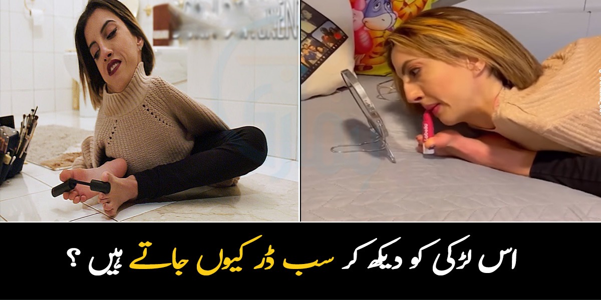 نہ بازو ہے نہ ہی ٹانگ ۔۔ یہ لڑکی ایسی کون سی بیماری میں مبتلہ ہے جس کی وجہ سے لوگ اسے دیکھ کر ڈرتے ہیں
