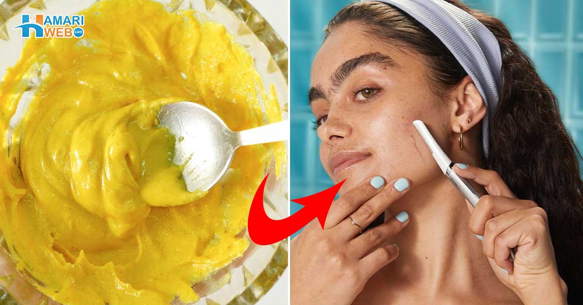 تھوڑی پر بال آ جائیں تو لوگ مذاق اڑاتے ہیں ۔ جانیں کچھ ایسی آسان ریمیڈیز جن کے استعمال سے چہرے کے بالوں کو صاف اور کم کرنے میں مدد ملے