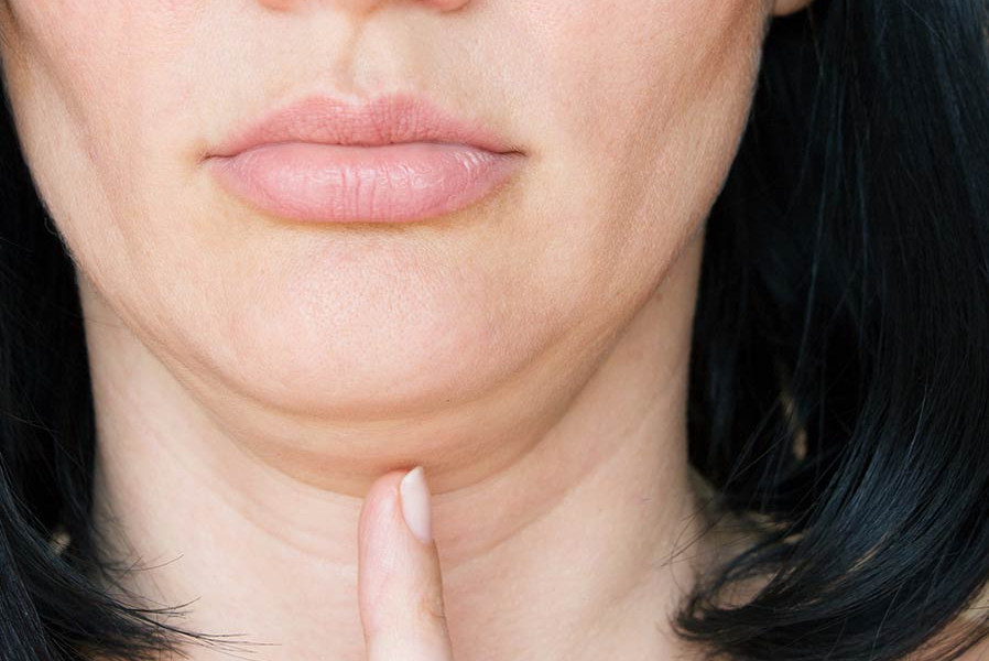 لٹکی ہوئی ڈبل چن ختم کرنے کا آسان طریقہ جو کرے اس کو تیزی سے ختم