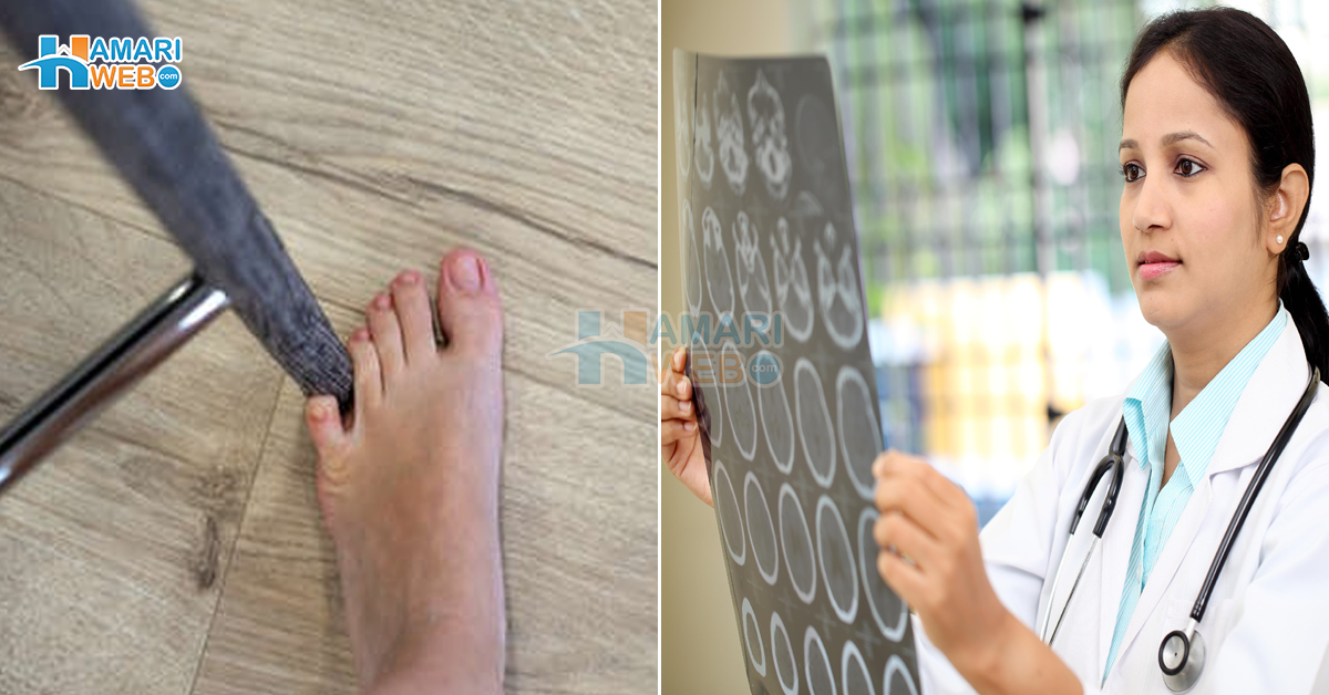 چھوٹی انگلی کہیں ٹکرا جائے تو دماغ ۔۔ پاؤں کی چھوٹی انگلی میں ہی ٹکرانے کے بعد شدید درد کیوں ہوتا ہے؟