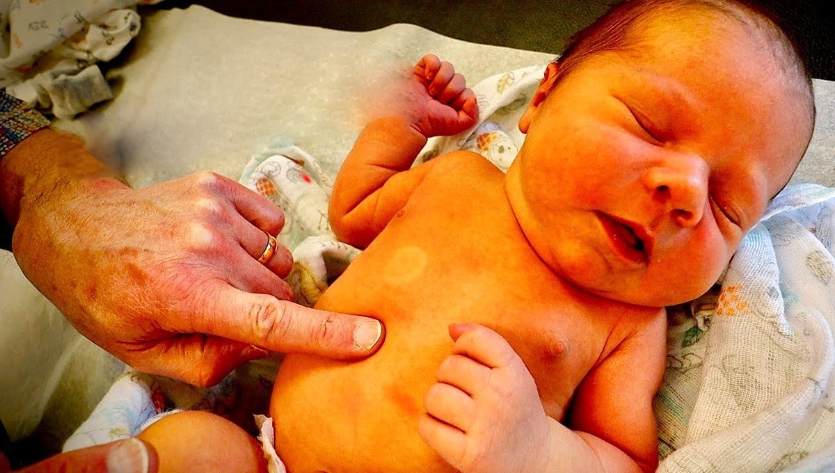 حمل کے دوران ڈاکٹر کی بتائی گئی کون سی چیز کھانے سے پیدا ہونے والے بچے کو پیلیا نہیں ہوتا ؟