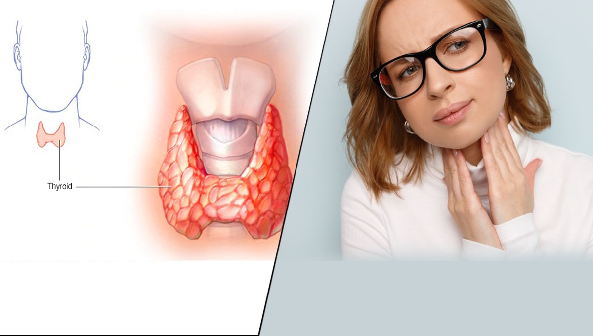تھائیرائیڈ کیا ہے؟ جانیں اس کی علامات وجوہات اور اس کو کنٹرول کرنے کا گھریلو نسخہ