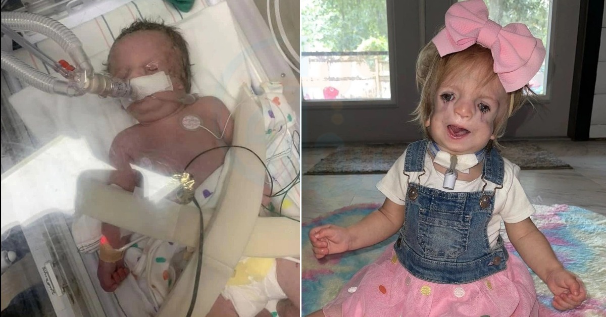 خود سے سانس بھی نہیں لے سکتی ۔۔ پیدائشی طور پر انوکھی بیماری میں مبتلہ بچی کو زندہ رہنے کیلیئے کیا کرنا پڑتا ہے ؟