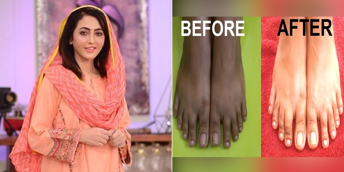 ڈاکٹر اُمِ راحیل نے بتایا کالے پاؤں کو صاف کرنے کا ایسا آسان طریقہ جو بنائے آپ کے پاؤں خوبصورت