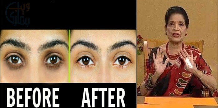 آنکھوں کے آگے اس طرح کے کالے حلقے پڑ گئے ہیں تو جانیں زبیدہ آپا کا بتایا وہ آسان طریقہ جس سے ہو کالے حلقے جلد ہی ختم اور چہرہ چمکے