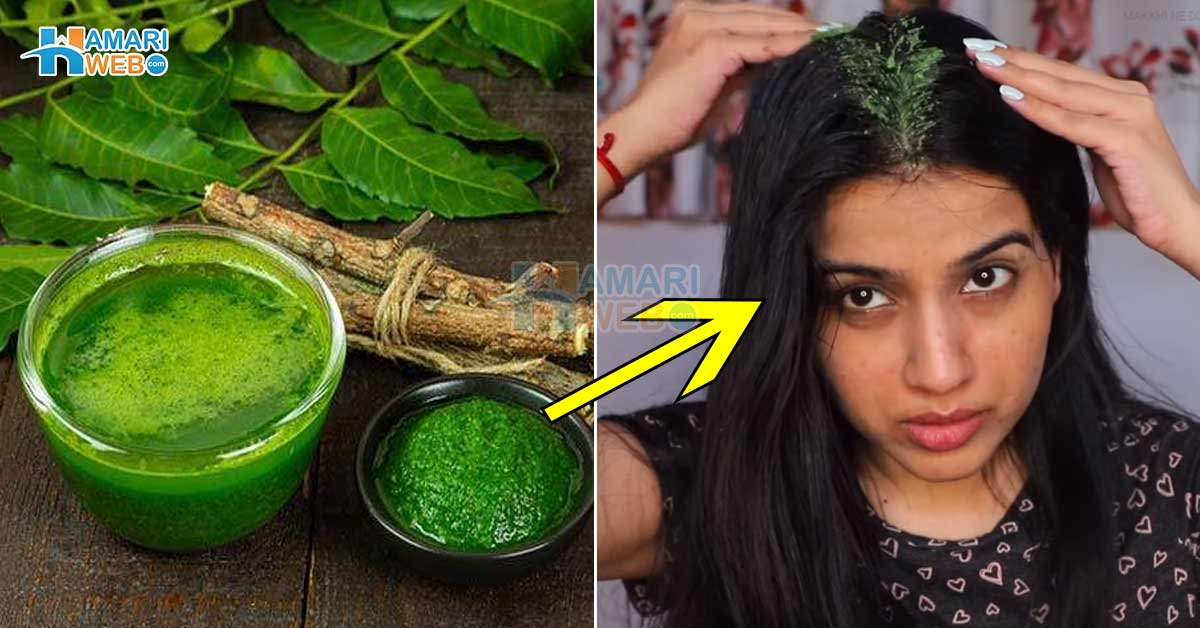 نیم سے کریں کی خشکی دور ۔۔ نیم کے پتوں کو بالوں میں لگانے کے وہ 4 طریقے، جس سے خشکی کا خاتمہ کیا جا سکتا ہے؟