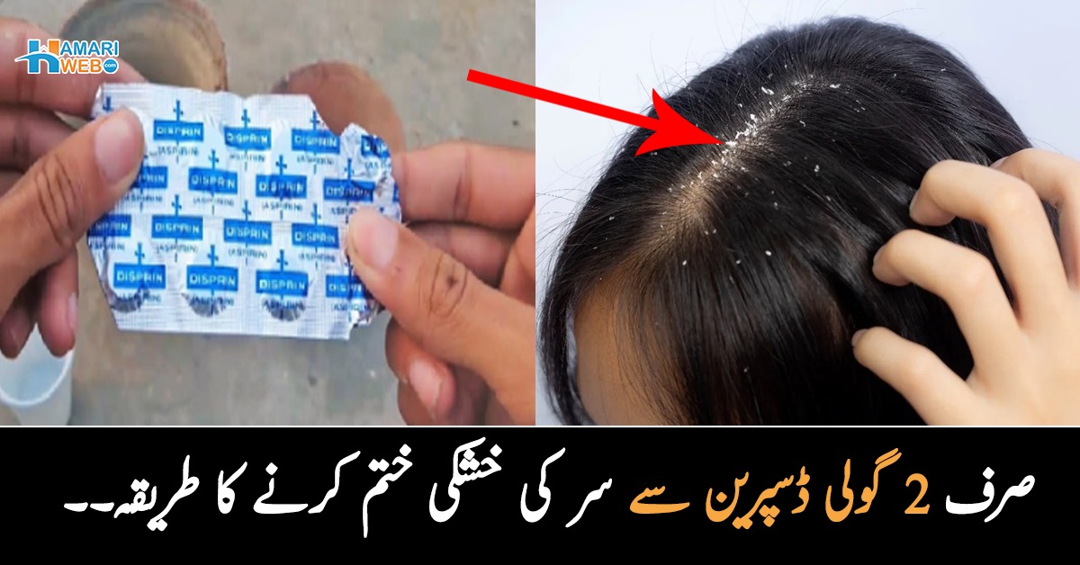 صرف 2 گولی ڈسپرین سے سر کی خشکی کیسے ختم کریں؟ مہنگے شیمپو اور تیل خرید کر تھک گئے ہیں تو ایک بار یہ بھی آزما لیں