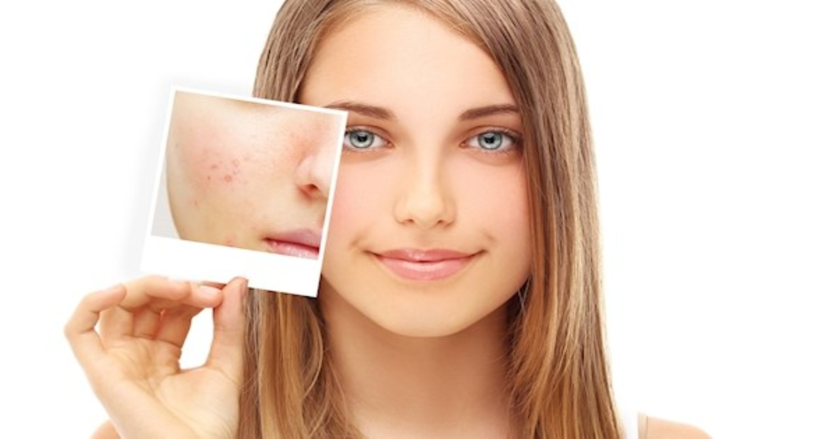 عید سے پہلے کریں اپنے چہرے کے داغ دھبے ختم اور رنگت صاف صرف بتائے گئے طریقے سے