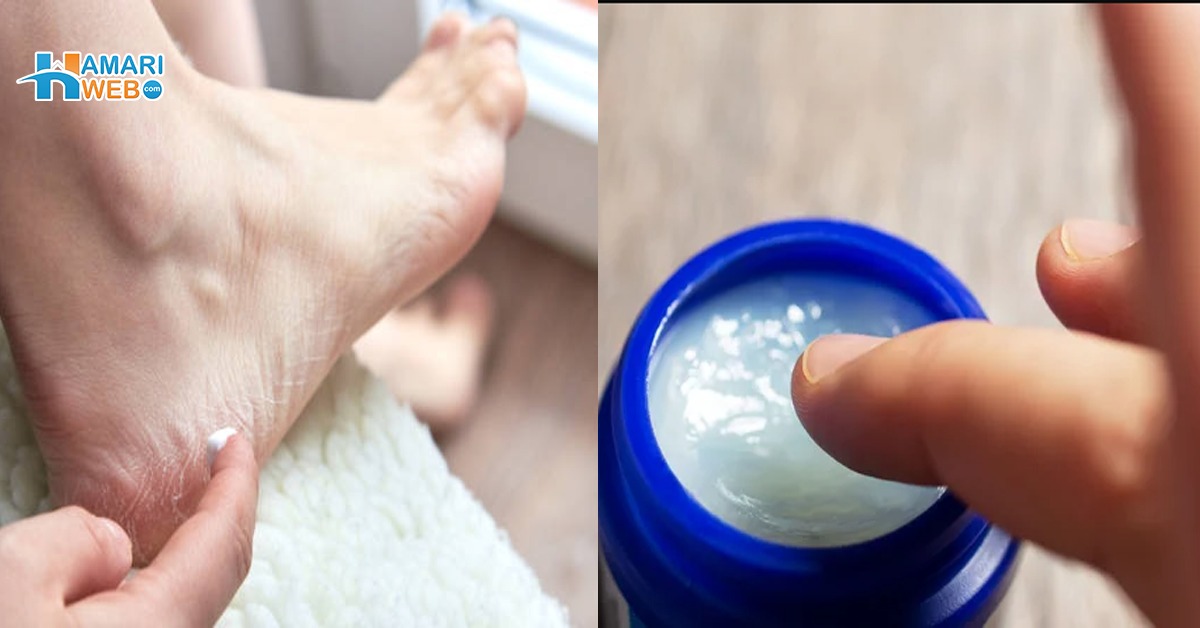 وکس سے پھٹی ایڑیاں بھی ٹھیک ہوتی ہیں ۔۔ جانیں سردی کے موسم میں وکس کے چند انوکھے استعمال، جو آپ کے کام آسان کرے