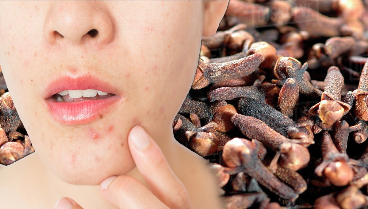 لونگ کو پیس لیں اور اس میں یہ ملاکر بتائے گئے طریقے سے چہرے پر لگائیں ۔۔۔۔ ایسا فائدہ ہوگا کہ نتائج دیکھ کر آپ بھی دنگ رہ جائیں گے