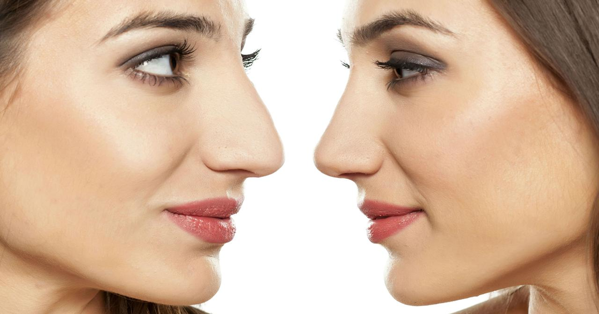 کیا آپکی ناک زیادہ موٹی ہے تو یہ ٹوٹکہ شروع کردیں چند دن کے استعمال سے ہی ناک پتلی ہوجائے گی