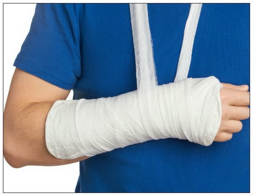 رانی آپا کا ٹوٹی ہوئی ہڈی کو فوری جوڑنے کا حیرت انگیز ٹوٹکہ