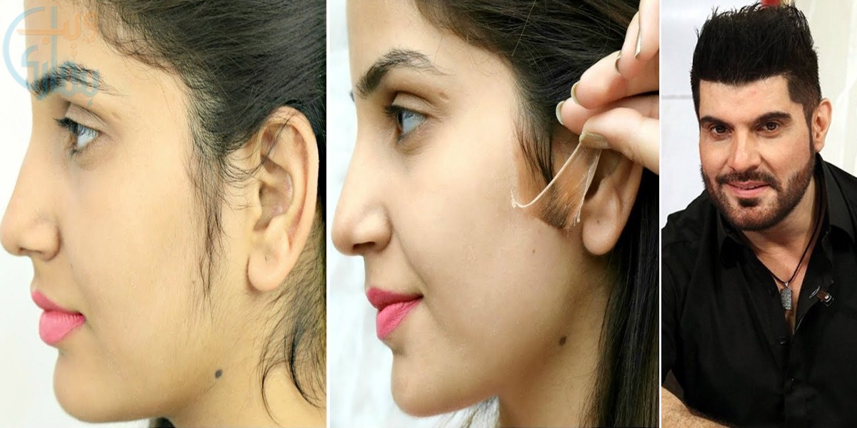 ڈاکٹر خرم نے بتایا چہرے کے غیر ضروری بالوں کو اس عام سی چیز سے صاف کرنے کا آسان طریقہ جس سے ہو ہر لڑکی کی بڑی مشکل آسان گھر بیٹھے