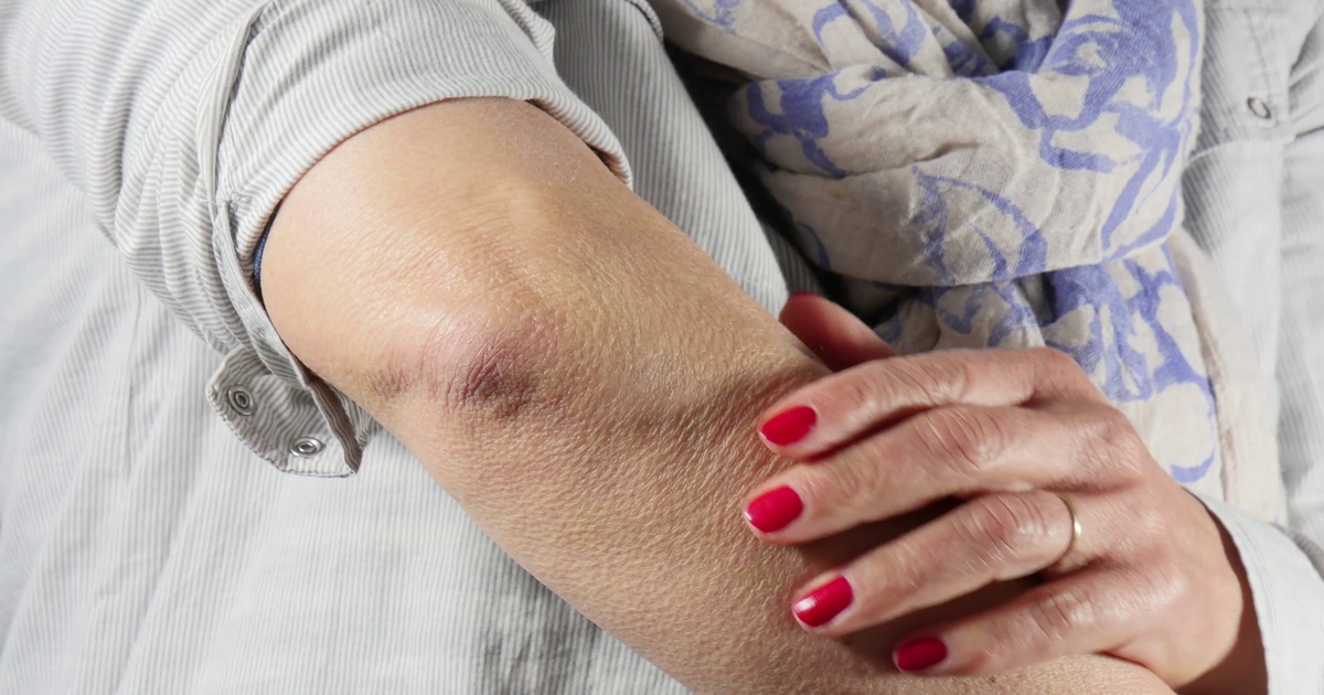 گردن اور کہنیوں کا کالا پن دور کرنے کے لئے آسان نسخہ