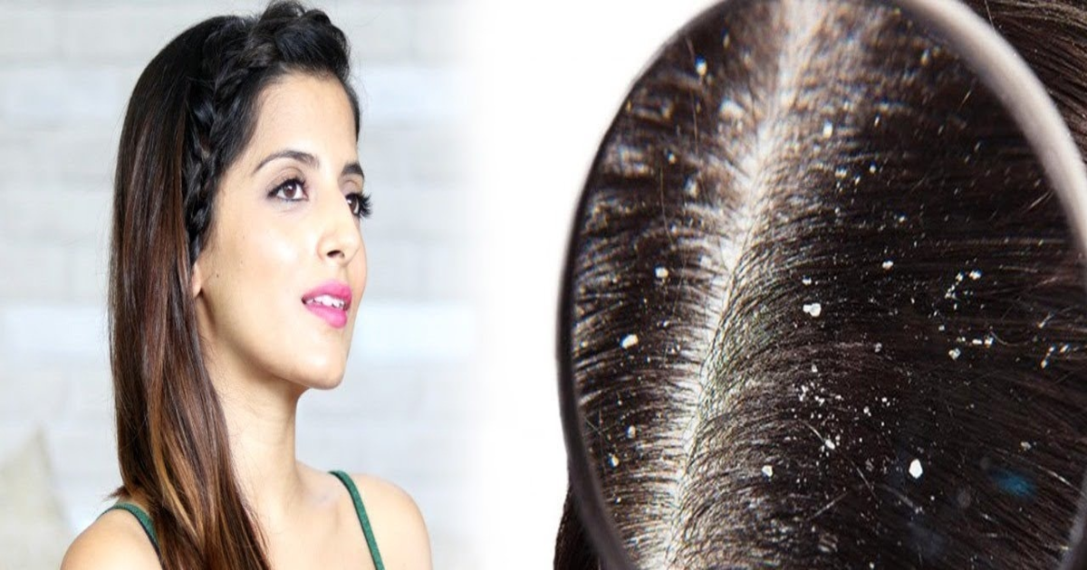 اس پھل سے کریں سر کی خشکی کا خاتمہ