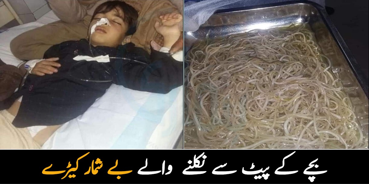 بچے کے پیٹ میں اتنے سارے کیڑے کیا چیز کھانے سے پیدا ہوئے؟ آپریشن نے ڈاکٹروں کو بھی حیران کر دیا