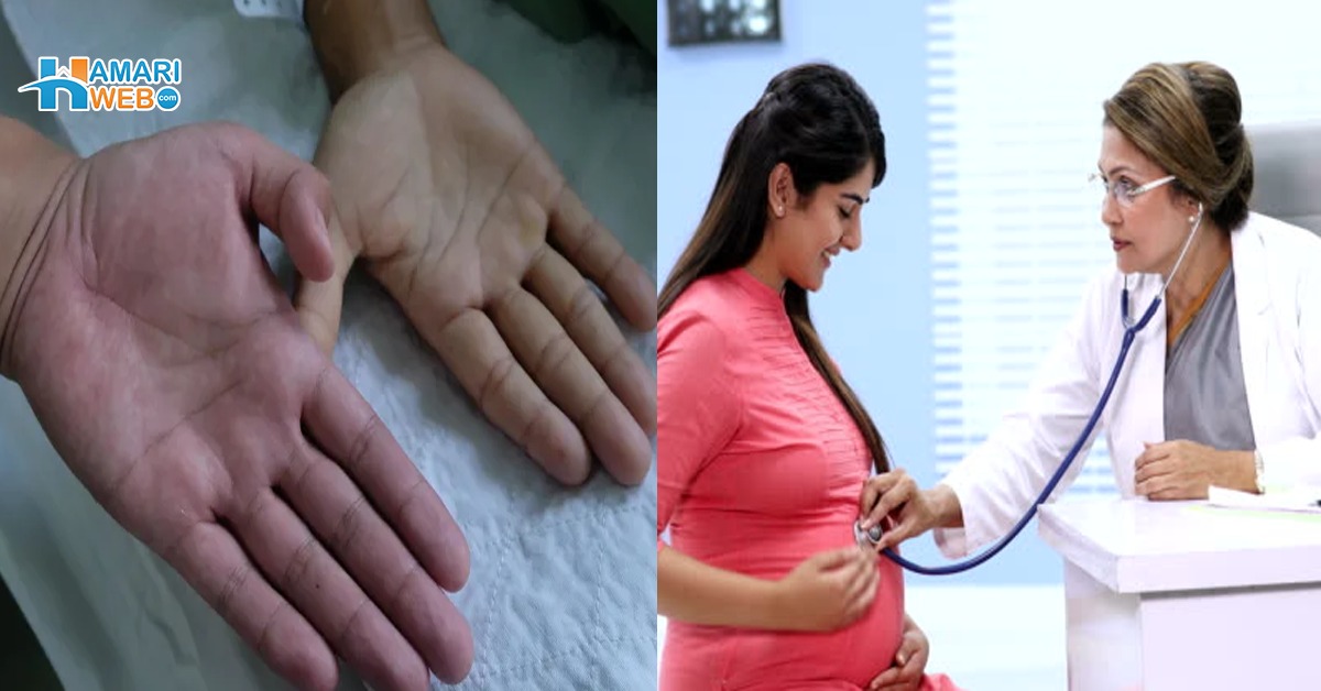 حاملہ عورت میں آئرن کی کمی ہو تو بچہ میں۔۔ ماں بننے والی عورتوں میں آئرن کی کمی دور کرنے والی غذائیں کون سی ہیں؟