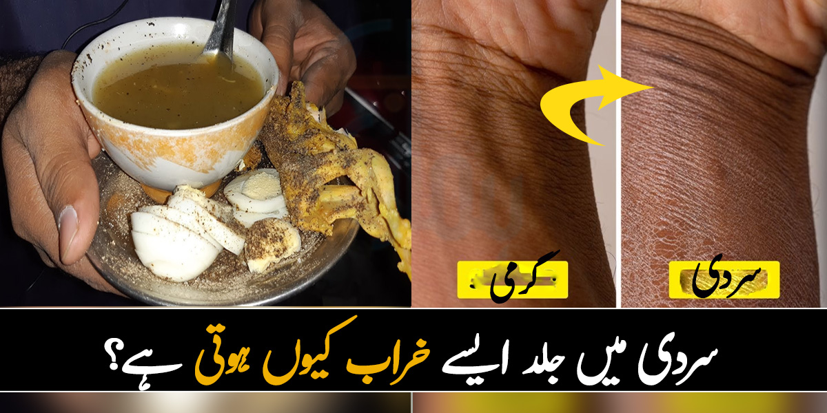 سردی میں جلد ایسے خراب کیوں ہوتی ہے؟ جانیئے سردی اور گرمی کے موسم میں ہونے والے کچھ ایسے مسائل جو ہر کسی کے ساتھ ہوتے ہیں