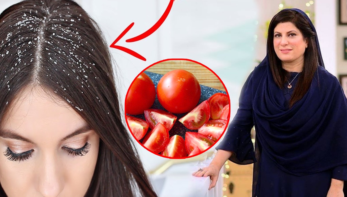 ڈاکٹر بلقیس نے بتایا بالوں سے خشکی ختم کرنے کا ایسا طریقہ جس کے بعد مہنگے شیمپو کی ضرورت نہیں پڑے گی