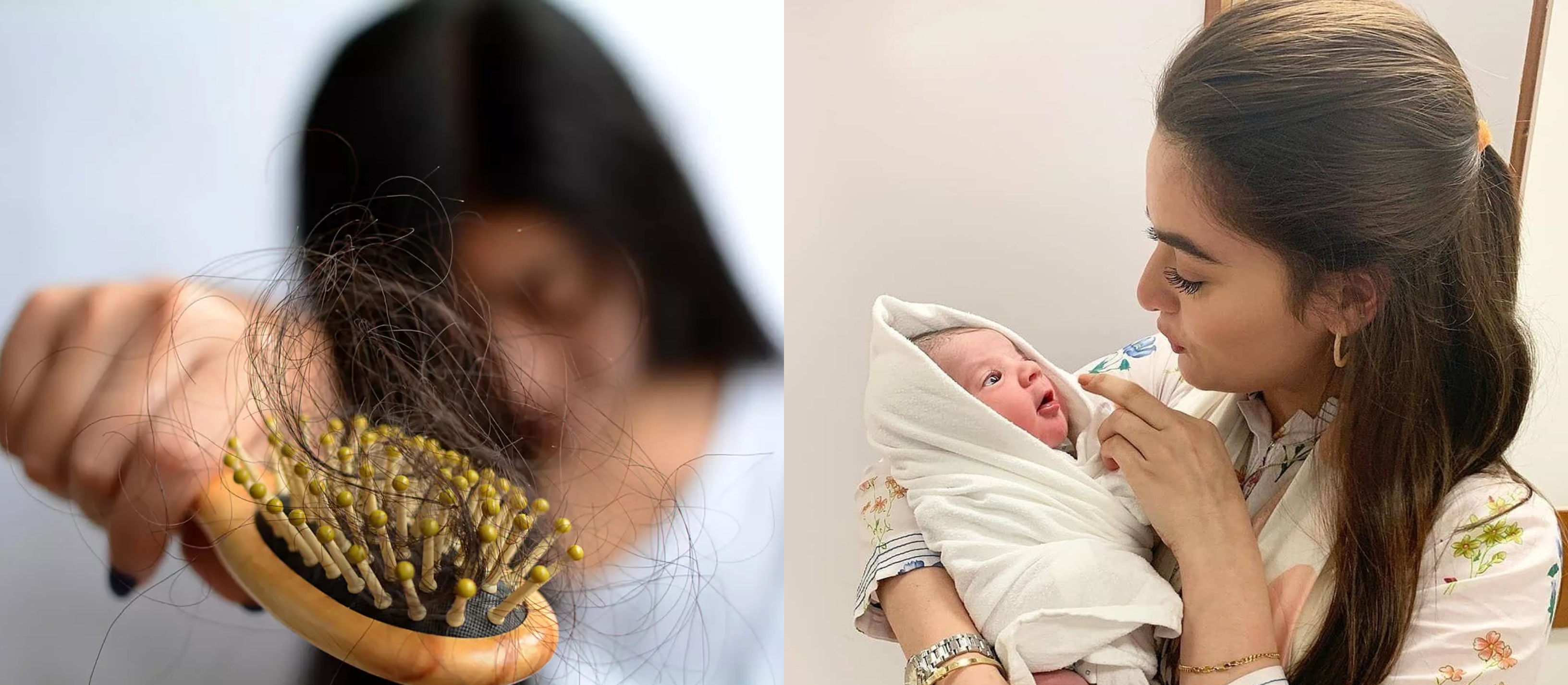 حمل کے بعد خواتین کے بال کیوں جھڑتے ہیں؟ جانیئے ماہرین اس حوالے سے کیا کہتے ہیں اور اسے کیسے روکا جا سکتا ہے؟