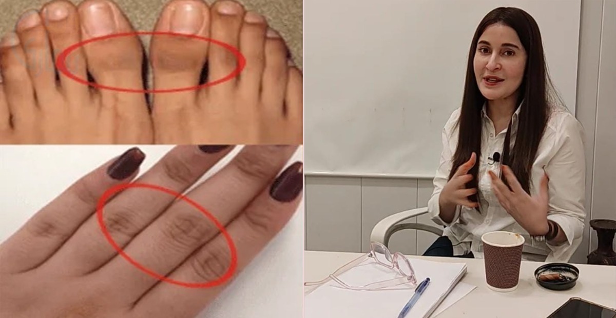 ہاتھ پاؤں کالے ہوگئے ہیں ۔۔ جانیئے ڈاکٹر شائستہ نے ہاتھوں کی سیاہ رنگت کو دور کرنے کا کون سا طریقہ بتا دیا