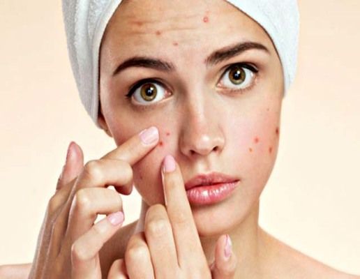 دانوں کے نشانات ختم کرنے کا ٹوٹکہ