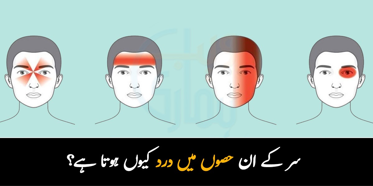 دماغ کی رگ پھٹ بھی سکتی ہے ! آنکھ کے پاس درد یا پھر آدھے سر کا درد ؟ جانیئے سر کے مختلف حصّوں میں ہونے والے درد کا مطلب کیا ہے