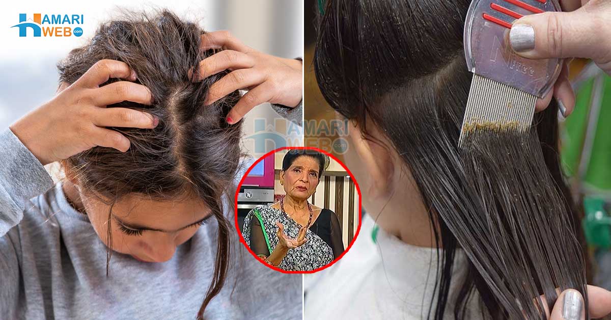 جوئیں سے تنگ ہو کر بال نہ نوچیں بلکہ۔۔ سر کی جوؤں سے جان چھڑانے والے زبیدہ آپا کے چند آزمودہ ٹوٹکے