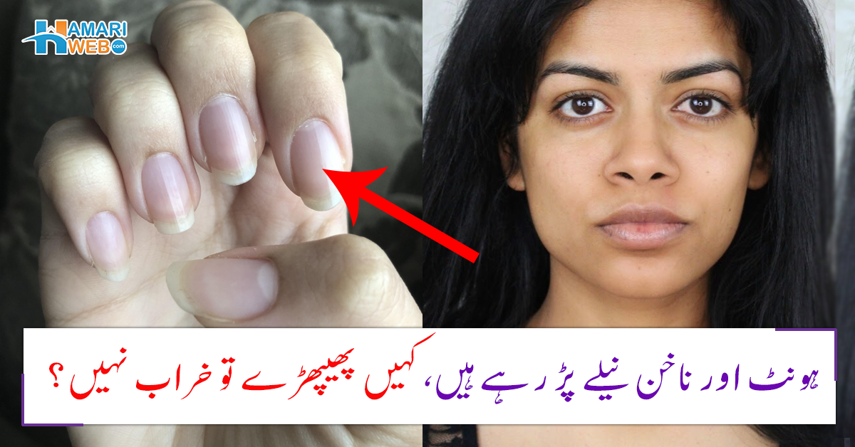 ہونٹ اور ناخن نیلے پڑ رہے ہیں، کہیں پھیپھڑے تو خراب نہیں؟ جانیں رنگت کی تبدیلی کی وہ علامات جو تشویش کا سبب بن سکتی ہیں
