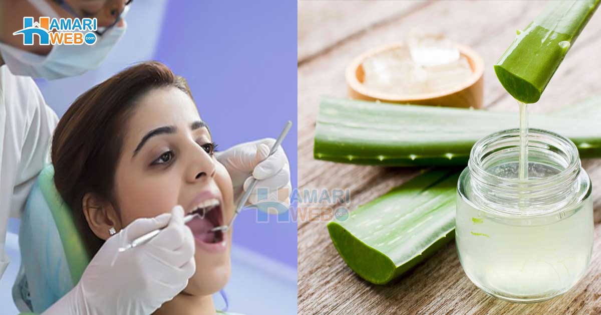 پان اور گٹکا کھانے سے دانت بالکل خراب ہوگئے ہیں ۔۔ ٹوتھ وائٹننگ کا 20 ہزار کا ٹریٹمینٹ کروانے کے بجائے ایلوویرا سے دانت چمکانے کا آسان طریقہ جانیں