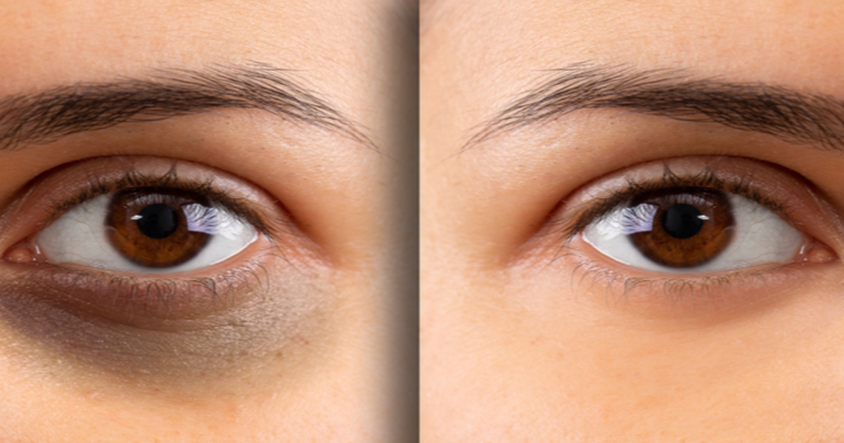 ویسلین میں یہ 1 چیز ملا کر لگانے سے آنکھوں کے گرد سیاہ حلقے ہوں چند ہی دنوں میں کم، ابھی آزمائیں اور چہرے کو خوبصورت بنائیں