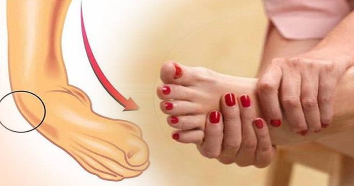 موچ آجائے تو فوری طور پر یہ نسخہ آزمائیں اور موچ کا درد بھگائیں