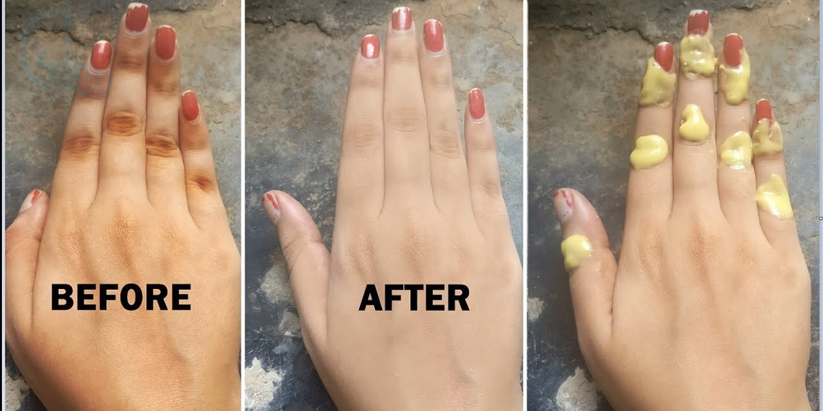 ہاتھ کی انگلیاں ایسی کالی ہوگئی ہیں تو ان کا رنگ صاف کرنے کے لئے کچن میں موجود اس عام سی چیز کو چند منٹ انگلیوں میں مل لیں تاکہ ہو ان کا رنگ جلد صاف