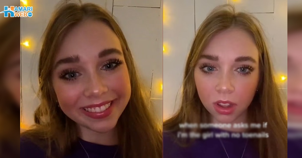 میں تنہا محسوس کرتی تھی اور پھر۔۔ ناخنوں کے بغیر پیدا ہونے والی لڑکی کو کن پریشانیوں سے گزرنا پڑ؟ دیکھئے ویڈیو