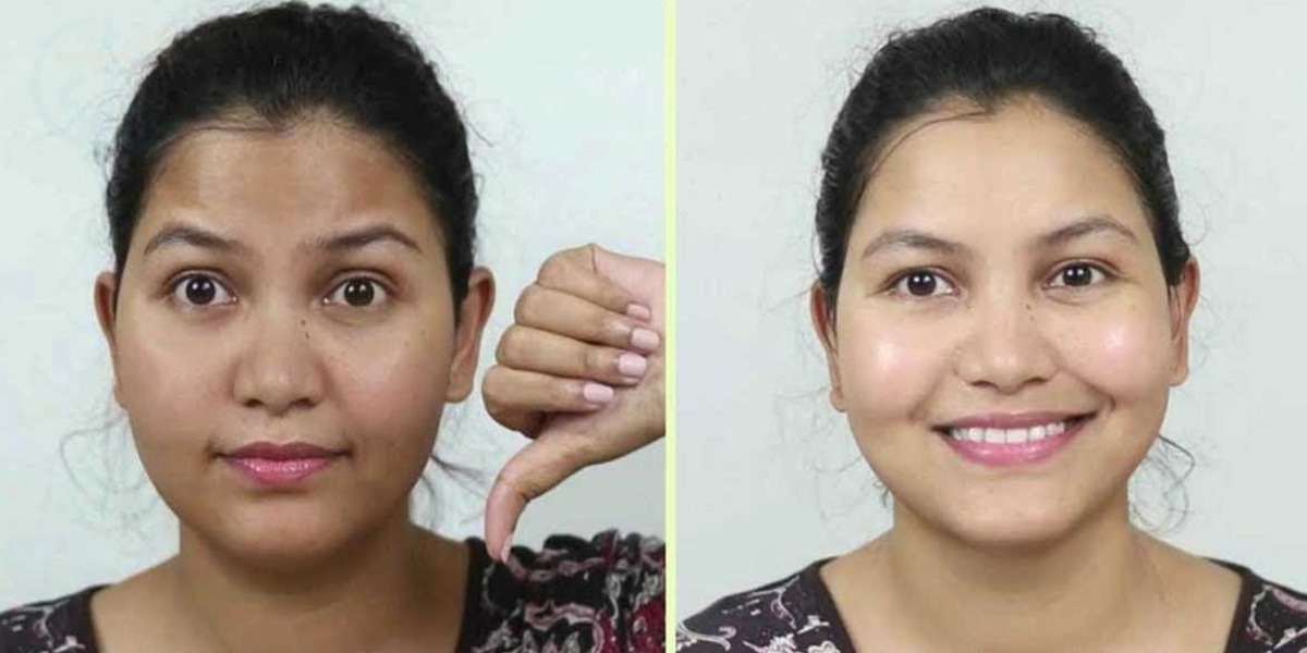 چہرے، گردن اور آنکھوں کے کالے گھیروں سے پریشان ہونے کی ضرورت نہیں کیونکہ ڈاکٹر نے بتا دی ہے سستی اور آسان ٹپ جو کرے آپ کے یہ 3 مسئلے منٹوں میں حل