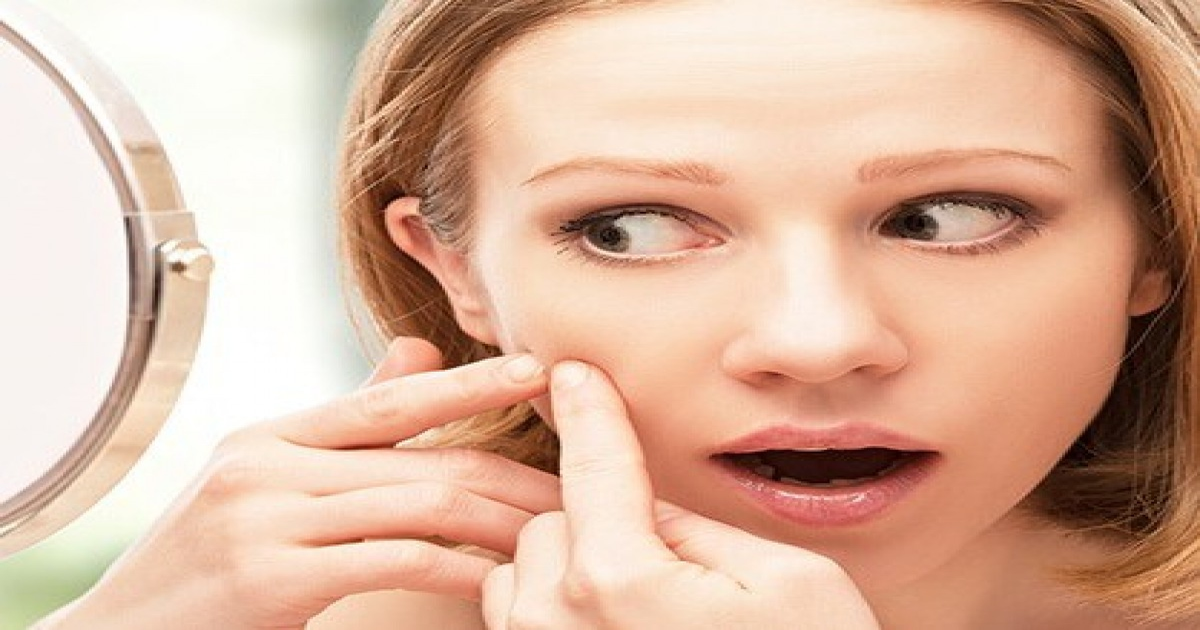 صرف تین دن میں لونگ سے ایکنی کا خاتمہ ممکن