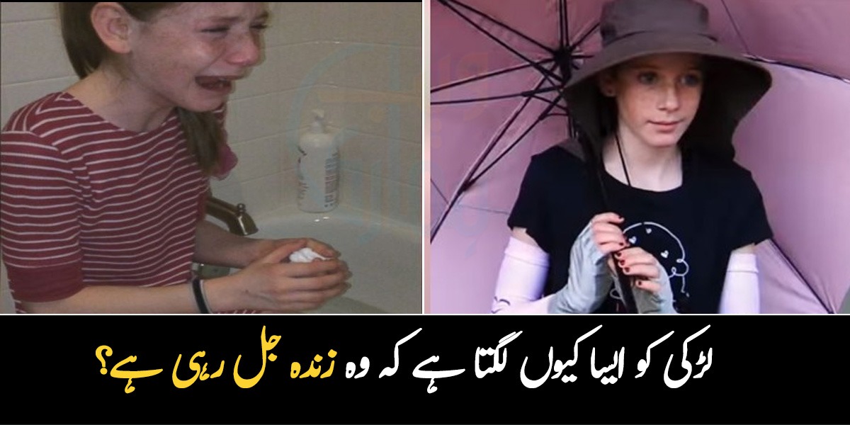 اس لڑکی کو ایسا کیوں لگتا ہے کہ وہ زندہ جل رہی ہے۔۔ اندھیروں میں رہنے والی بچی کی حیران کر دینے والی کہانی