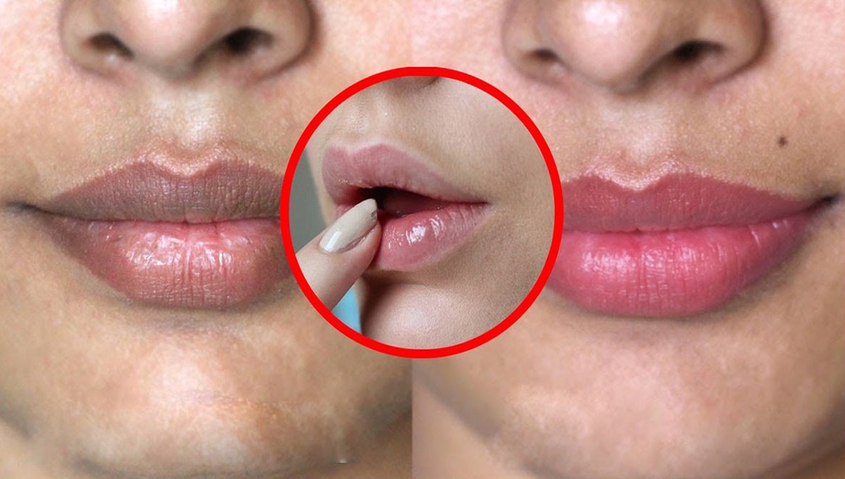 کالے ہونٹ! وہ کونسی عادات ہیں جن سے آپ کے ہونٹ کالے ہو جاتے ہیں۔۔ جانیں ان کو دوبارہ سے گلابی بنانے کا آسان طریقہ