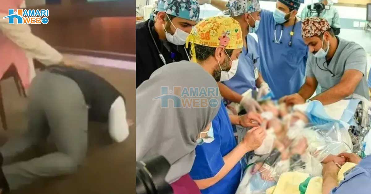 جسم جڑے 2 بچوں کا 11 گھنٹے چلنے والا طویل آپریشن ۔۔ مشکل ترین آپریشن کے بعد بچوں کا باپ روتے ہوئے سجدے میں گر پڑا، بچوں کی حالت اب کیسی ہے؟