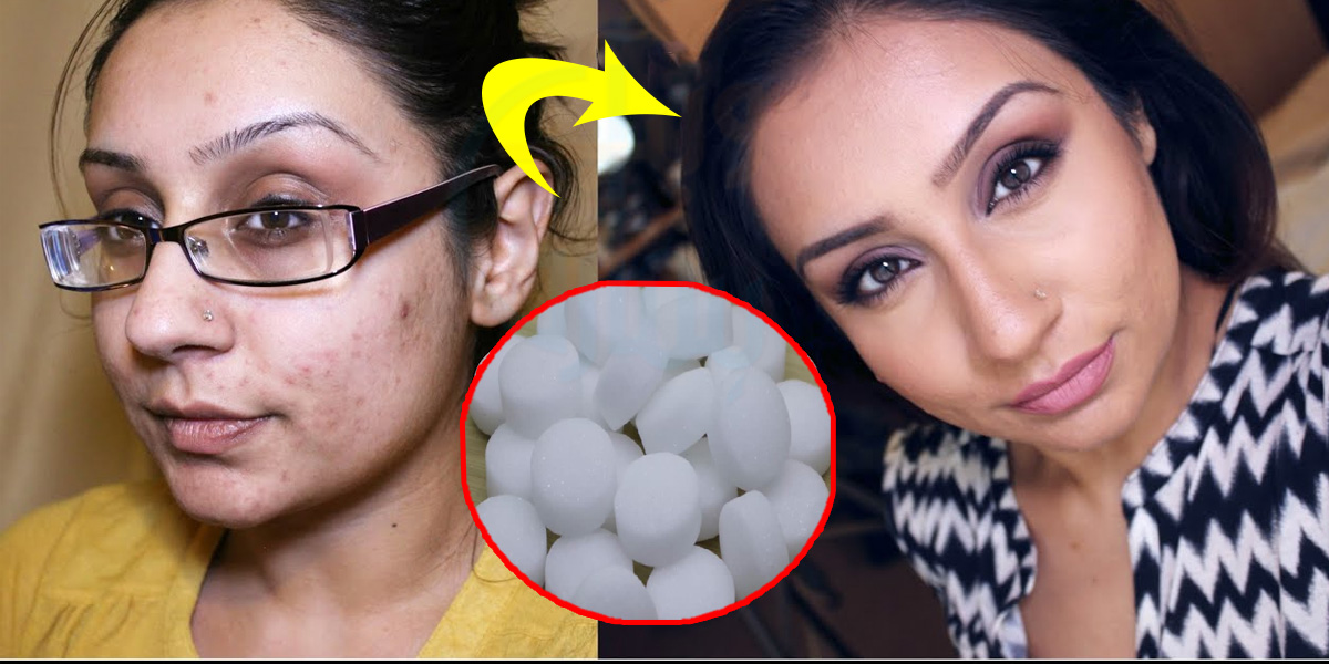 چہرے کے داغ دھبے صاف کرتا ہے ۔۔ سستے کافور کے کچھ ایسے فائدے جو خواتین کو ضرور معلوم ہونے چاہیئیں