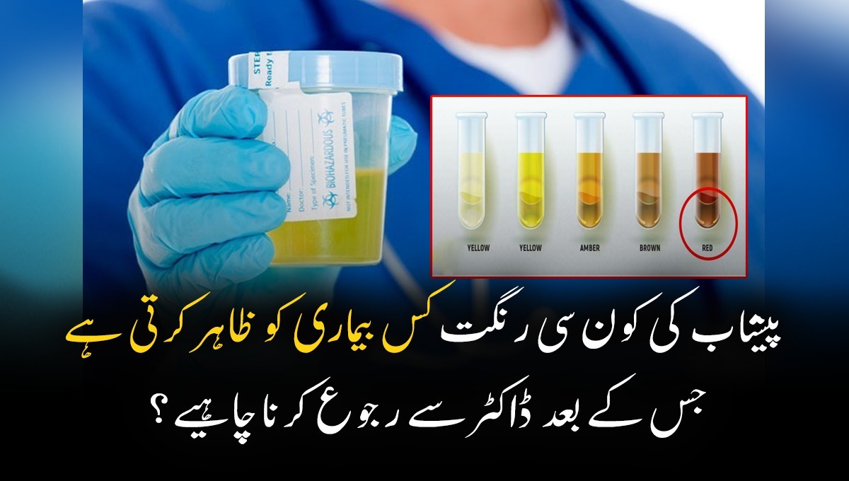 اگر آپ کو بھی اس رنگ کا پیشاب آرہا ہے تو فوراً ڈاکٹر سے رجوع کریں۔۔۔ جانئیے کون سی رنگت کس بیماری کو ظاہر کرتی ہے